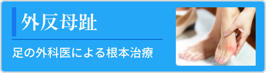 外反母趾